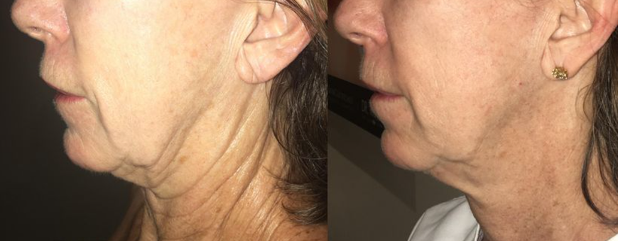 1eb932de-image-1_10o609v0o609g000007000