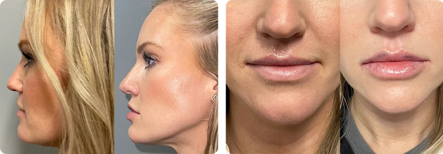 66ee2e3e-before-after_10o808g0o608g000000000