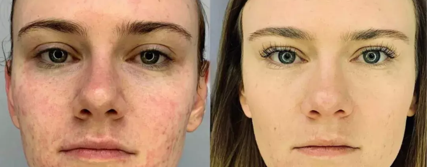 77960534-244df31c-1-55db9de7-1920w-1_10o60d70o609g00001v000